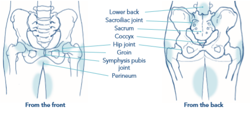 Pelvic girdle pain (PGP) —